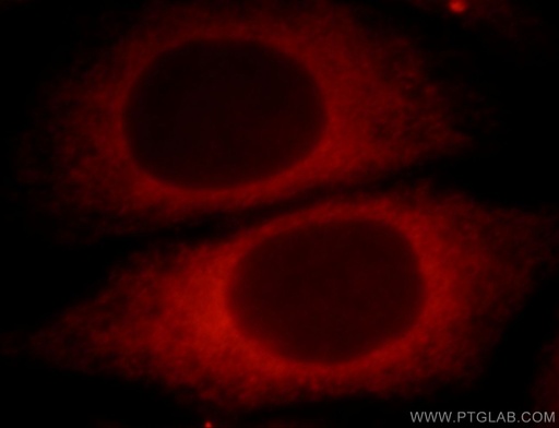 [21052-1-AP-20UL] UBXD2 Polyclonal antibody
