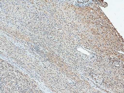 [21059-1-AP-20UL] PNO1 Polyclonal antibody
