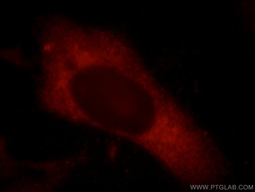 [21064-1-AP-20UL] Synaptopodin Polyclonal antibody