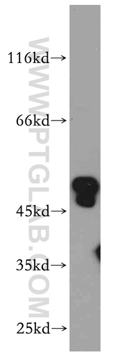 [21065-1-AP-150UL] ANKMY2 Polyclonal antibody