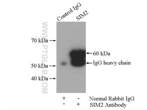 [21069-1-AP-150UL] SIM2 Polyclonal antibody