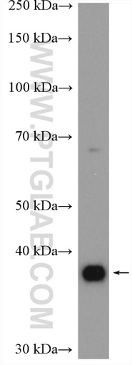 [21071-1-AP-20UL] ADORA2B Polyclonal antibody