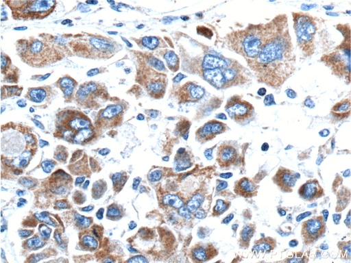 [21072-1-AP-150UL] MEKK3 Polyclonal antibody