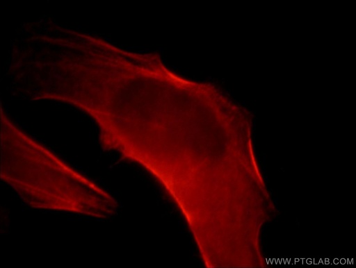 [21073-1-AP-20UL] CNN2 Polyclonal antibody