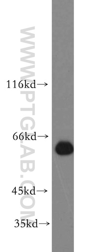 [21075-1-AP-20UL] ZNF703 Polyclonal antibody