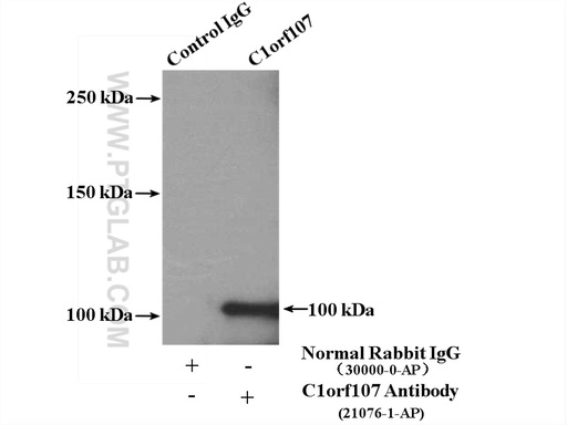 [21076-1-AP-150UL] C1orf107 Polyclonal antibody