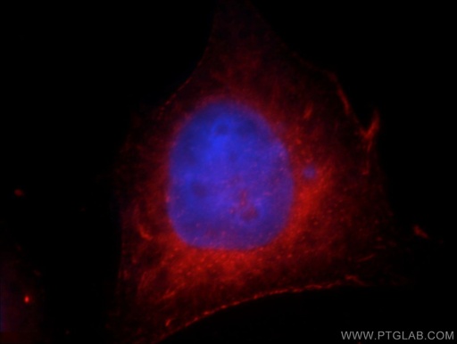 [21079-1-AP-20UL] FAM119A Polyclonal antibody