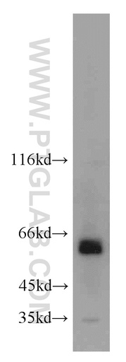 [21080-1-AP-20UL] ACBD5 Polyclonal antibody