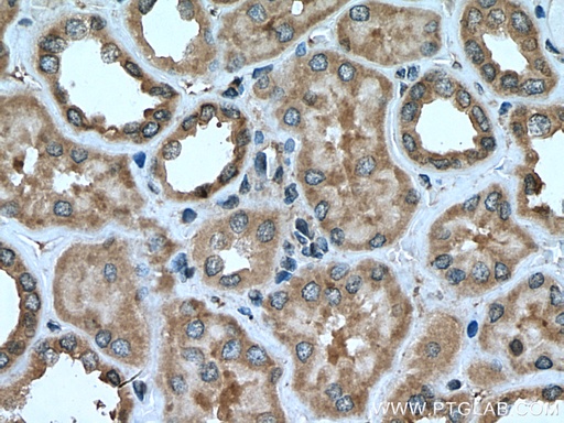 [21082-1-AP-150UL] CCDC50 Polyclonal antibody