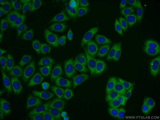 [21085-1-AP-150UL] TBC1D19 Polyclonal antibody