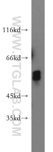 [21088-1-AP-20UL] GCM2 Polyclonal antibody