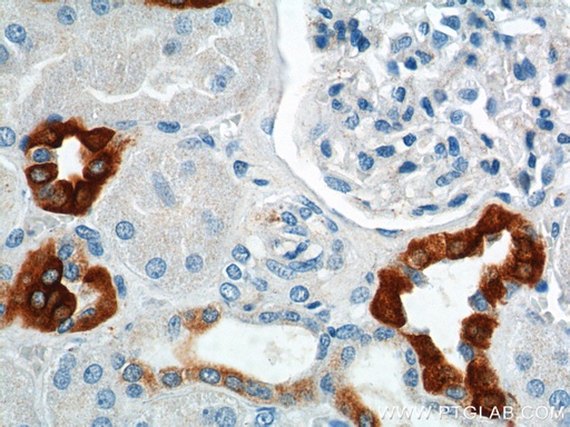 [21089-1-AP-20UL] GPRC5D Polyclonal antibody