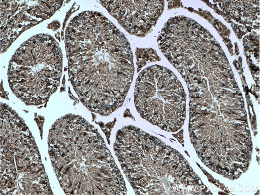 [21090-1-AP-20UL] CHCHD4 Polyclonal antibody