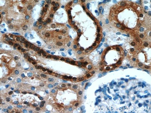 [21091-1-AP-150UL] HDDC3 Polyclonal antibody