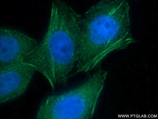 [21093-1-AP-20UL] AFAP1 Polyclonal antibody