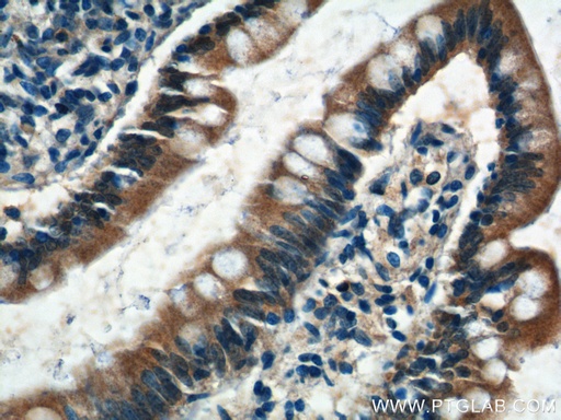 [21098-1-AP-150UL] C1orf51 Polyclonal antibody