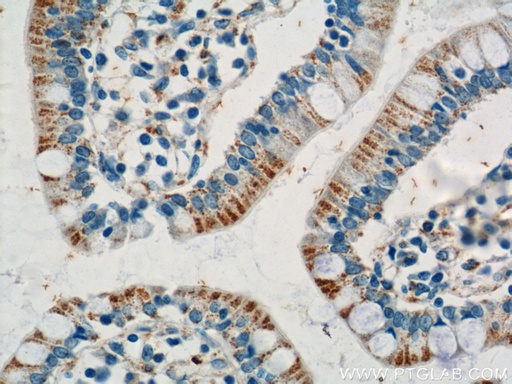 [21100-1-AP-150UL] ANKRD13D Polyclonal antibody
