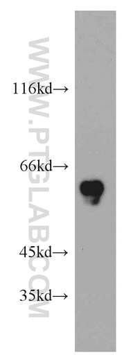[21104-1-AP-20UL] CCDC9 Polyclonal antibody