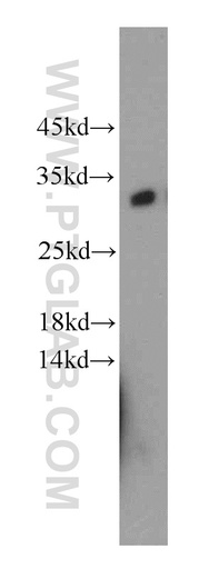 [21111-1-AP-20UL] KCTD14 Polyclonal antibody