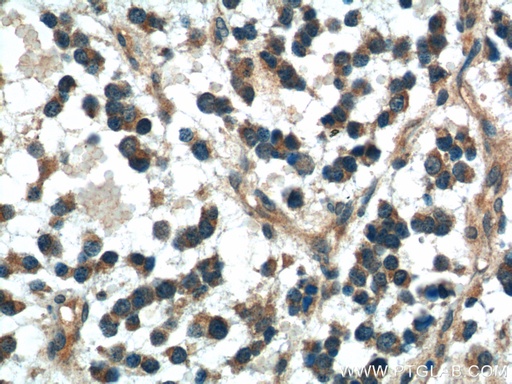[21112-1-AP-20UL] DKK1 Polyclonal antibody