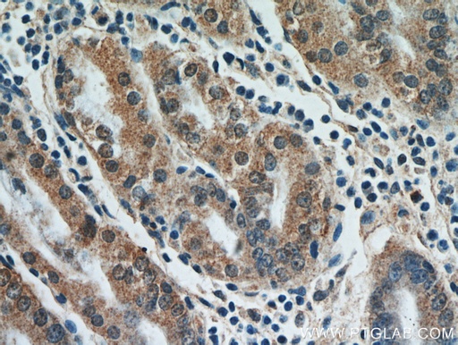 [21113-1-AP-20UL] FAM101A Polyclonal antibody