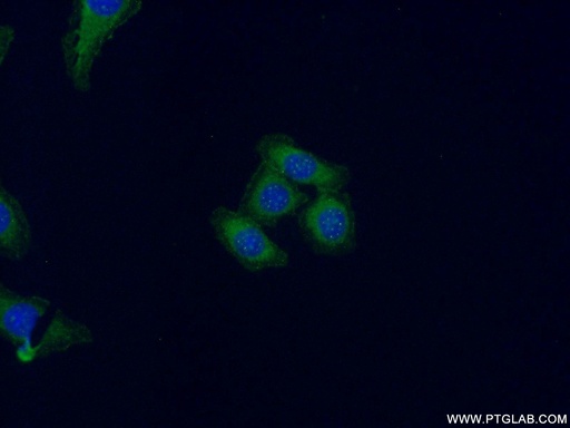 [21126-1-AP-20UL] Claudin 18 Polyclonal antibody