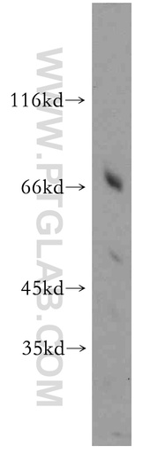 [21128-1-AP-150UL] HPSE2 Polyclonal antibody