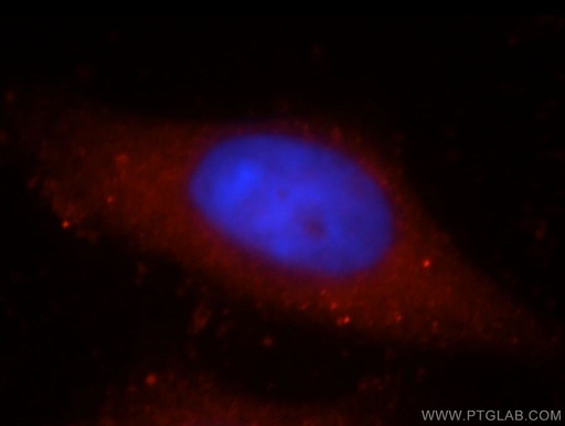 [21129-1-AP-150UL] KIAA1199 Polyclonal antibody