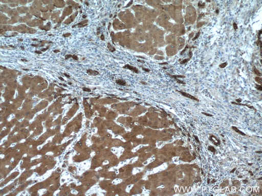 [21131-1-AP-150UL] Ceruloplasmin Polyclonal antibody