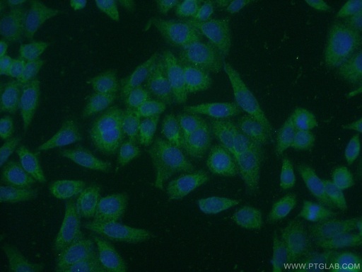 [21132-1-AP-150UL] MAN2A1 Polyclonal antibody