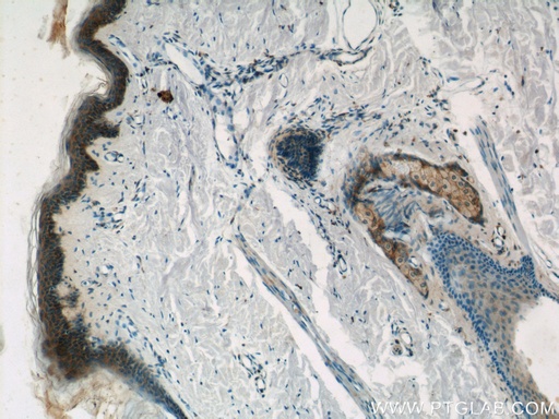 [21134-1-AP-150UL] PGLYRP4 Polyclonal antibody