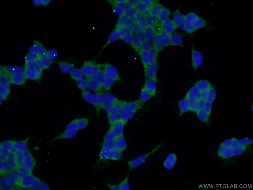 [21137-1-AP-20UL] SPACA3 Polyclonal antibody