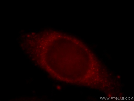 [21138-1-AP-20UL] KIAA0528 Polyclonal antibody