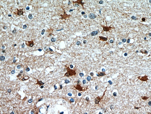 [21142-1-AP-20UL] SCGBL Polyclonal antibody