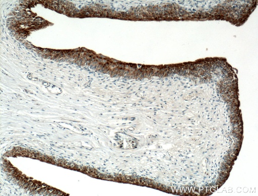 [21149-1-AP-150UL] UPK2 Polyclonal antibody