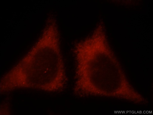 [21152-1-AP-150UL] KIR2DS4 Polyclonal antibody