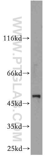 [21153-1-AP-150UL] LILRA4 Polyclonal antibody