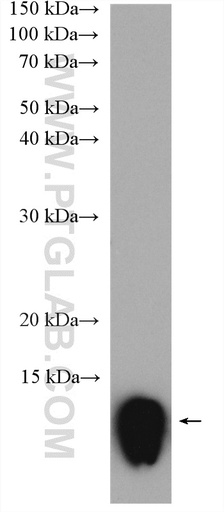 [21157-1-AP-20UL] PF4 Polyclonal antibody