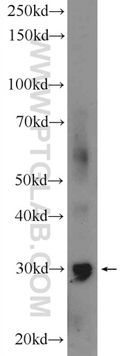 [21158-1-AP-20UL] GIYD2 Polyclonal antibody
