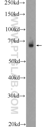 [21159-1-AP-150UL] TEAD2 Polyclonal antibody