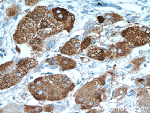 [21160-1-AP-20UL] ELOVL6 Polyclonal antibody