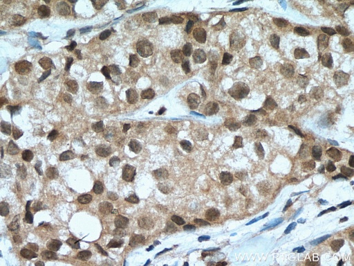 [21162-1-AP-20UL] TOX2 Polyclonal antibody