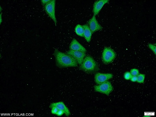 [21166-1-AP-150UL] MKL1 Polyclonal antibody