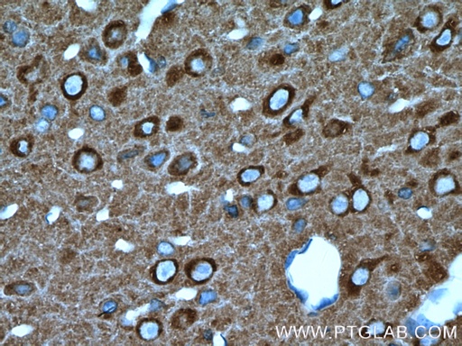 [21172-1-AP-20UL] NSF Polyclonal antibody