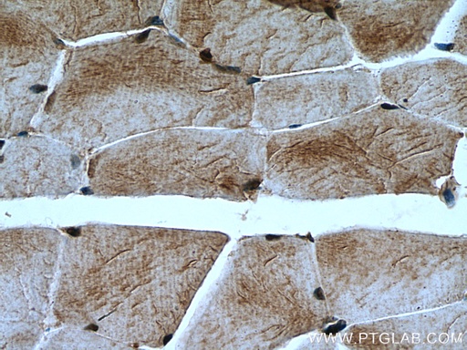 [21173-1-AP-150UL] MYLK2 Polyclonal antibody
