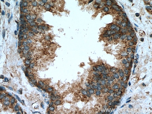 [21176-1-AP-20UL] PPM2C Polyclonal antibody