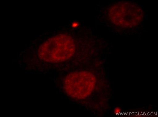 [21179-1-AP-150UL] CBLL1 Polyclonal antibody