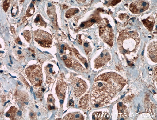 [21181-1-AP-150UL] C11orf57 Polyclonal antibody