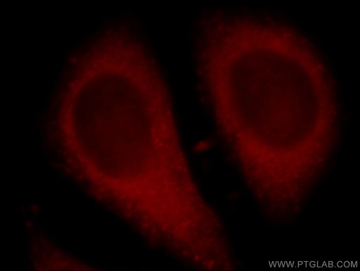 [21183-1-AP-150UL] C13orf18 Polyclonal antibody