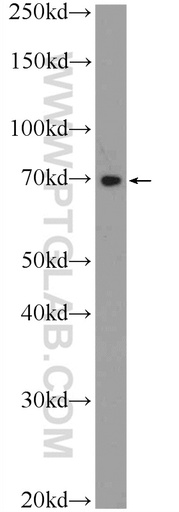 [21185-1-AP-150UL] TTC30B Polyclonal antibody